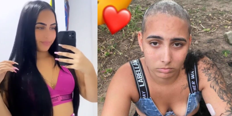 A jovem ficou cheia de buraco na cabeça após passarem a máquina no zero. Foto: Reprodução