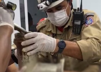 A vítima não teve o nome revelado e passou por cirurgia de amputação. Foto: Reprodução