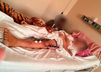 A mulher foi identificada e passou por diversas cirurgias. Foto: Reprodução