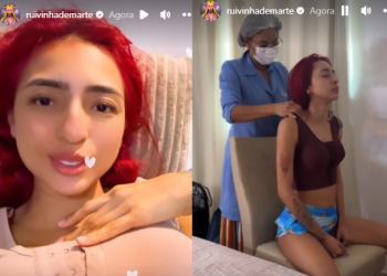 A cirurgia, segundo ela, foi um sucesso. Foto: Reprodução