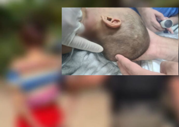 O menino tinha ainda lesões cerebrais, segundo a delegada Joyce Coelho, da Depca. Foto: Divulgação