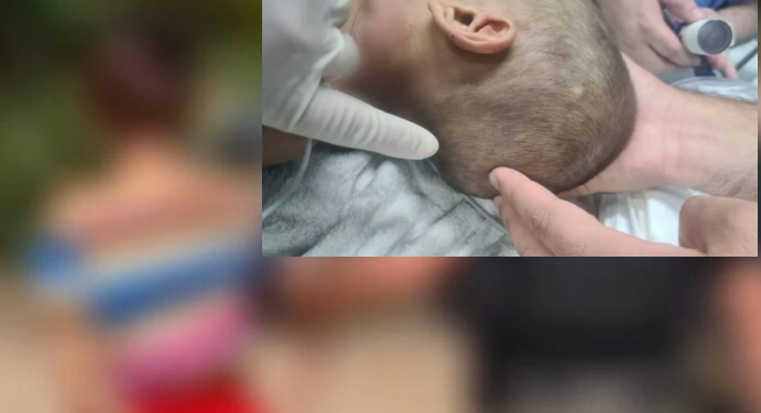 O menino tinha ainda lesões cerebrais, segundo a delegada Joyce Coelho, da Depca. Foto: Divulgação