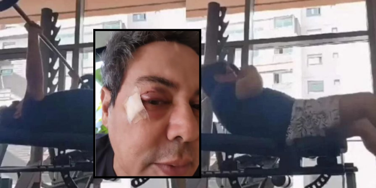 O vocalista levou alguns pontos e teve que passar por exames. Foto: Reprodução