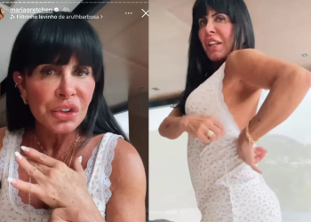 Nesta quarta-feira (29), ela contou que já fez três vezes o procedimento. Foto: Reprodução