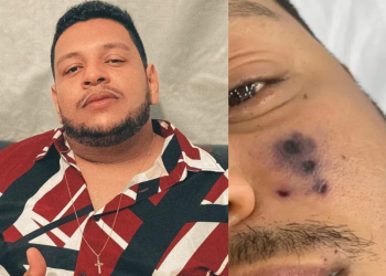 O rosto de Darlyn Morais começou a escurecer após a picada. Foto: Reprodução