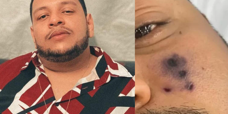 O rosto de Darlyn Morais começou a escurecer após a picada. Foto: Reprodução