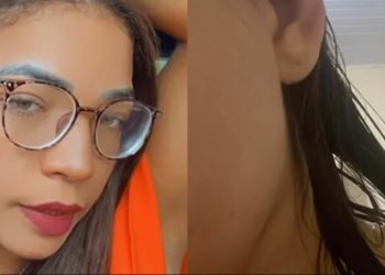 A vítima disse que foi atacada no local de trabalho. Foto: Reprodução