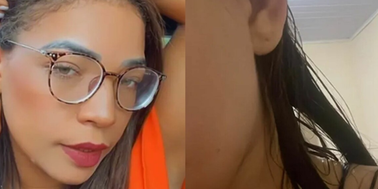 A vítima disse que foi atacada no local de trabalho. Foto: Reprodução