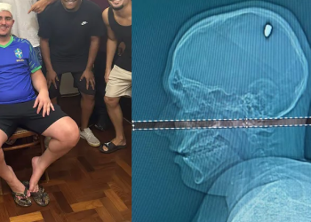 O estudante só começou a se sentir estranho após quatro dias. Foto: Reprodução