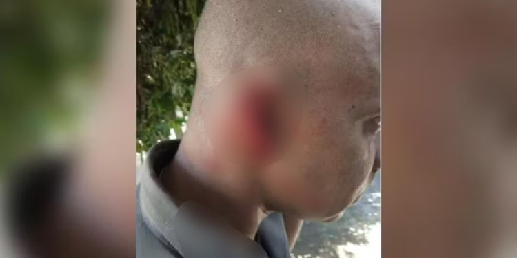 O fato ocorreu na última sexta-feira (19) e o agressor foi preso. Foto: Reprodução