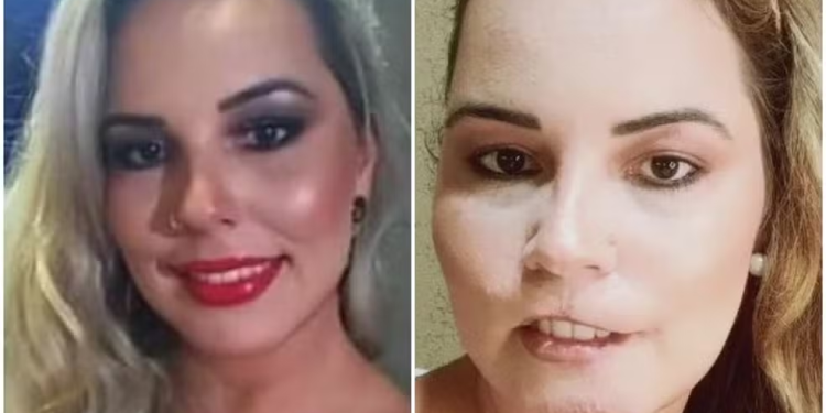 Mariana Michelini, de 35 anos, passou por um pesadelo. Foto: Reprodução