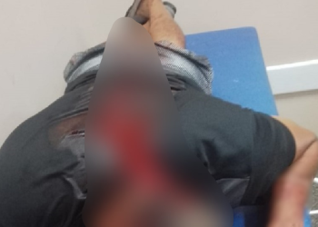 O homem foi socorrido e levado a uma unidade hospitalar. Foto: Reprodução