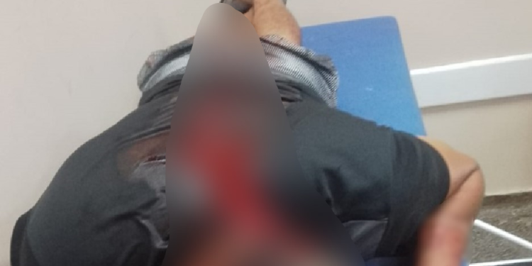 O homem foi socorrido e levado a uma unidade hospitalar. Foto: Reprodução