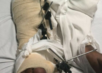 O fato ocorreu na madrugada de domingo (10). Foto: Reprodução