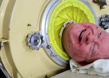 Paul Alexander foi uma das vítimas de uma epidemia de poliomielite em Dallas, nos EUA. Foto: Reprodução