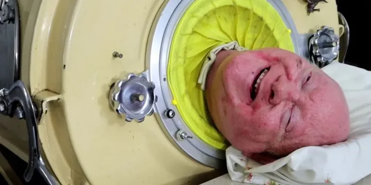 Paul Alexander foi uma das vítimas de uma epidemia de poliomielite em Dallas, nos EUA. Foto: Reprodução