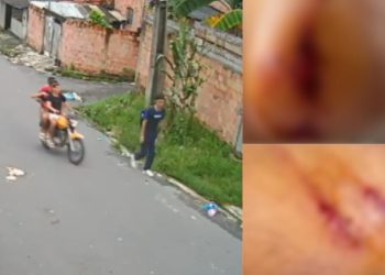 Vídeo: estudante que foi espancado durante assalto na ZL de Manaus ficou com o olho roxo, braços feridos e boca estourada