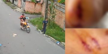 Vídeo: estudante que foi espancado durante assalto na ZL de Manaus ficou com o olho roxo, braços feridos e boca estourada