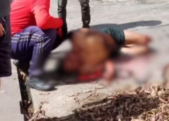 'Menino de vó' fica cuspindo sangue após receber carinho da população em Manacapuru