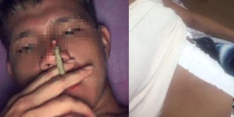 Com vários BOs por agressão, jovem 'chapado' esfaqueia a cunhada no Mauazinho durante a madrugada