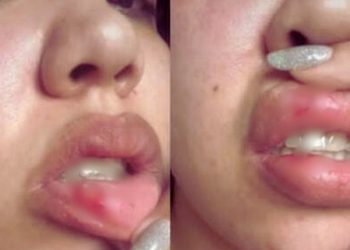 Cantora de Manaus acusa namorado de agressão e mostra hematomas pelo corpo