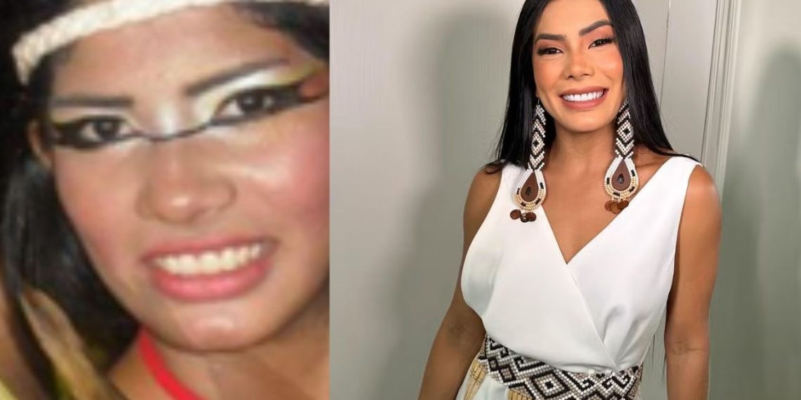 Marciele responde internauta que criticou seus procedimentos estéticos: "faz terapia"