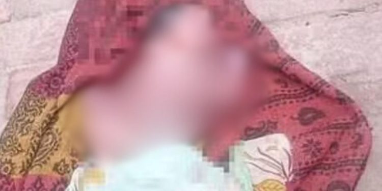 Veja a foto do bebê que nasceu com quatro pernas, quatro braços e dois rostos