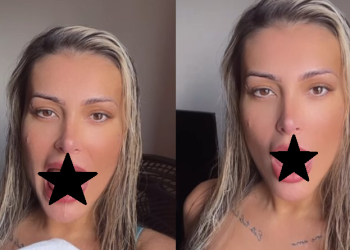 Andressa Urach fez o procedimento para dar mais prazer. Foto: Reprodução