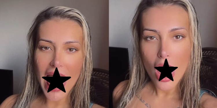 Andressa Urach fez o procedimento para dar mais prazer. Foto: Reprodução
