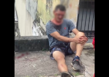 O homem foi bastante espancado. Foto: Reprodução