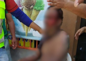 VÍDEO: Homem quase morre ao tocar em fio de alta tensão e despencar de poste em Manaus