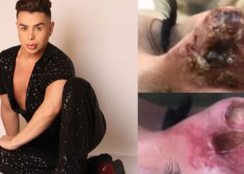 Ouça: Dentista ‘famosinho’ em Manaus é acusado de deixar nariz de paciente ‘podre’ após rinomodelação