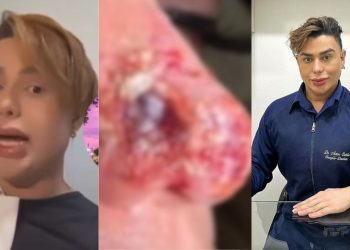 Dentista de Manaus se manifesta após ser acusado de deixar nariz de paciente necrosado: "Cada caso é um caso"