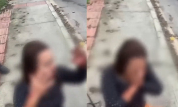 A vítima lutou com o agressor e teve o rosto arrebentado com socos. Foto: Reprodução