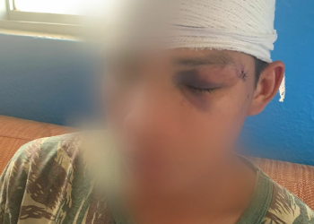 O rapaz levou também pontos na cabeça. Foto: Reproduçaõ