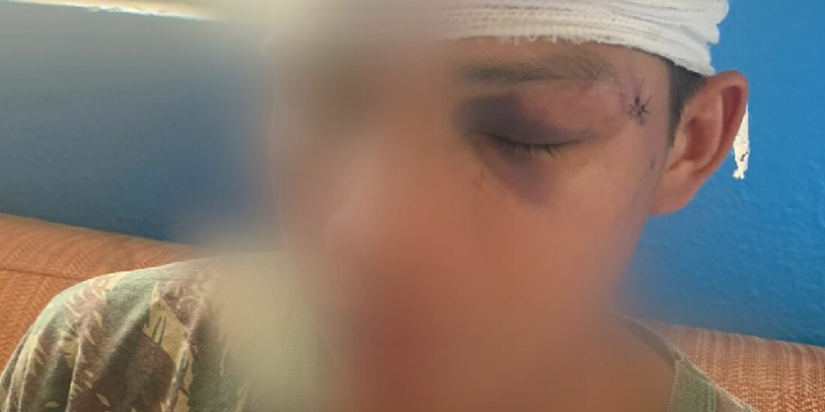 O rapaz levou também pontos na cabeça. Foto: Reproduçaõ