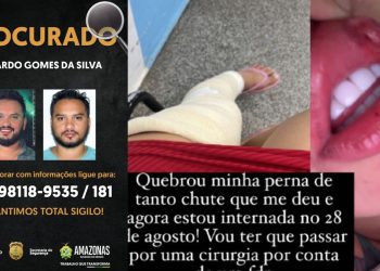 Procurado por ajudar a desovar corpo de babá já foi acusado de quebrar a perna da ex em Manaus