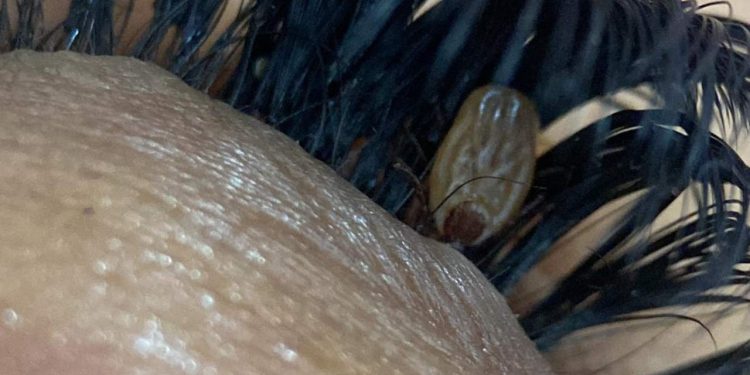 O caso aconteceu em Vitória, no Espírito Santo. Foto: Reprodução