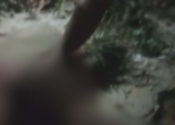 Vídeo: À beira da morte, homem recebe oração após ser baleado no rosto no Jorge Teixeira