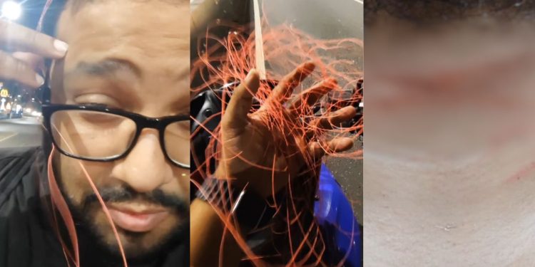 "Quase sou degolado": Jornalista fica com o pescoço ferido após passar por linha com cerol na Bola do Coroado