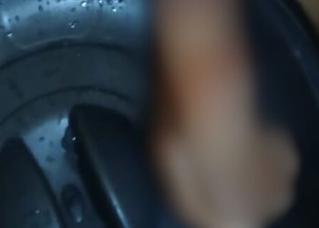 Pistoleiros deixam um morto e mulher baleada na perna no Santa Etelvina; veja