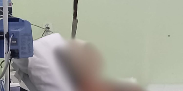 Bizarro! Mulher dá entrada no hospital em Manaus com a faca cravada na cabeça; veja