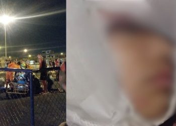 IMAGEM FORTE: Menina de 9 anos tem o couro cabeludo arrancado enquanto brincava em parquinho infantil