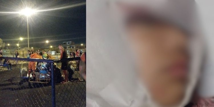 IMAGEM FORTE: Menina de 9 anos tem o couro cabeludo arrancado enquanto brincava em parquinho infantil