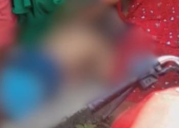 Vídeo: Morador de Coari fica em estado grave após ser alvejado enquanto caminhava na rua