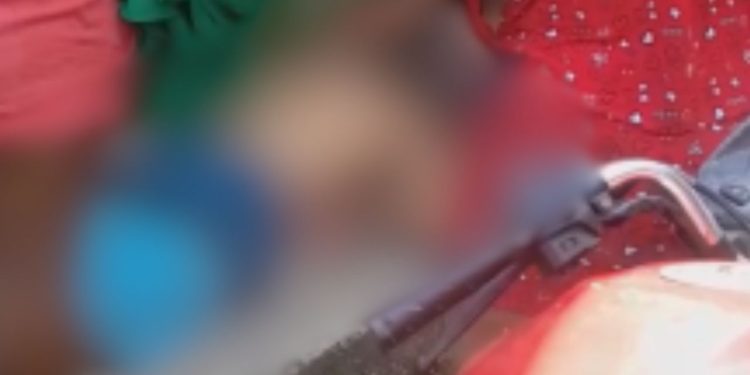 Vídeo: Morador de Coari fica em estado grave após ser alvejado enquanto caminhava na rua