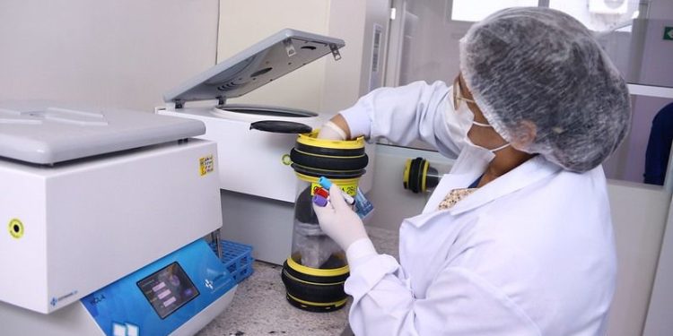 Este ano, de janeiro a setembro, a unidade já realizou 1.843.269 de exames. Foto: Evandro Seixas/SES-AM e Mauro Neto/ Secom