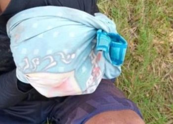 Segundo ataque de jacaré é registrado no Amazonas; pescador ficou sem o braço