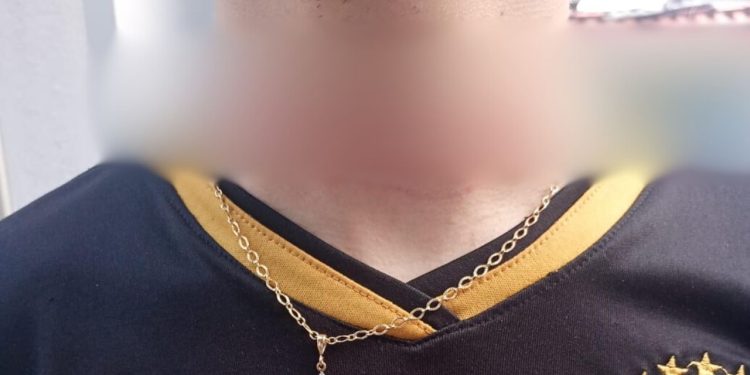 Linha de cerol quase corta pescoço de motociclista na avenida Cosme Ferreira e faz alerta: '