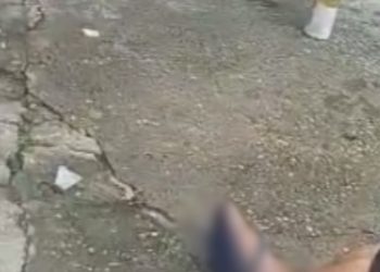 Vídeo mostra homem que ficou com o pé dil4cerad0 após pisar em catolé em Manaus